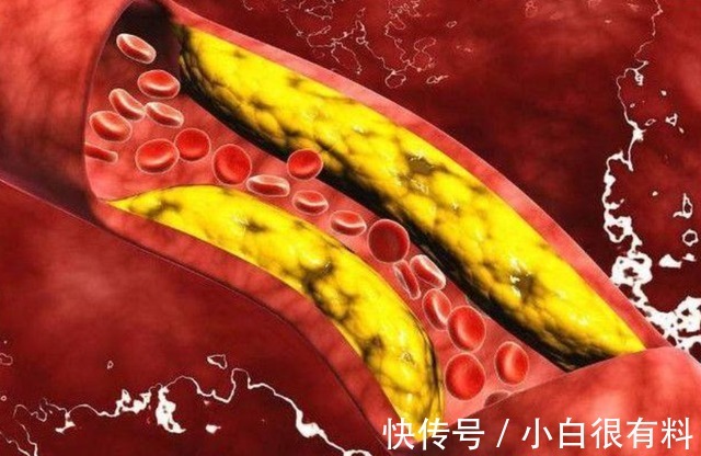 喝茶|喝白开水的人与长期喝茶的人相比,哪个更健康?