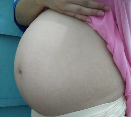 胎儿妊娠发|为啥同孕情况下,肚子差距那么大?孕妈别疏忽