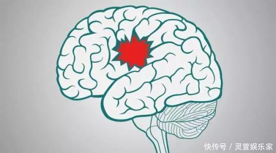 年轻人|专家提醒年轻人瑜伽运动不当容易造成中风！