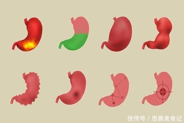 癌细胞|饿治百病，是真的吗？长寿专家直言不讳：四类病真能饿没了