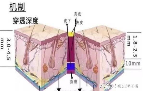 做完超声刀可以洗脸吗,怎样保养错了抓紧改正~