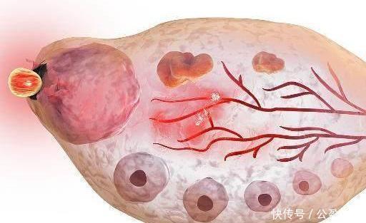 出血|女人1个月排几次卵当卵子排出体外时，身体会有这3种感觉