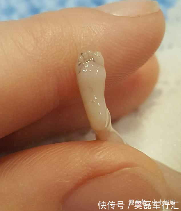 月月花|女子流产后,将14周“孩子”放进冰箱并分享,照片中孩子仅10厘米