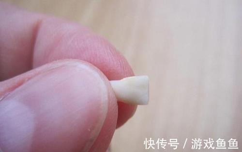 孩子|孩子这颗牙有大“作用”,父母别再乱丢了,关键时刻能救娃一命