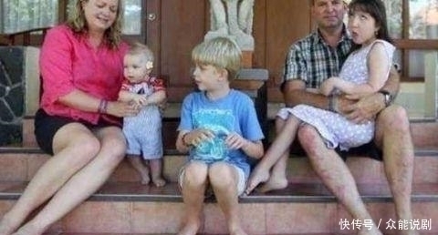 父母|为了让女儿停止发育，父母切除了她的子宫，称这是对她最大的保护