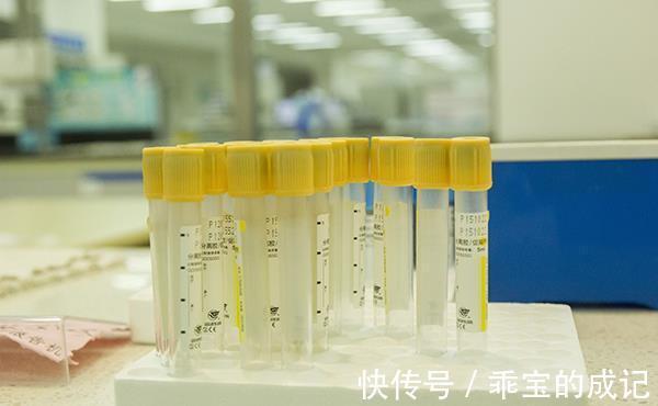 支架|62岁教授,血管狭窄从90%降低到70%,支架都免了,患者分享方法