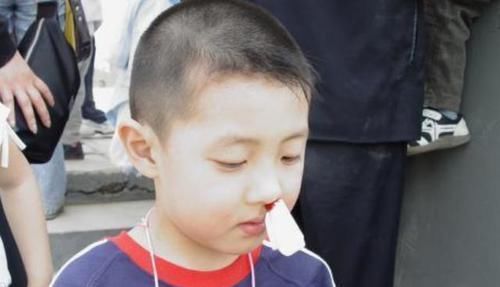 宝妈|3岁男孩摔倒流鼻血,宝妈错误的处理后,医生也“无力回天”