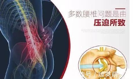 绝招|民间老郎中家传绝招！一个4味药的泡酒方，腰突疼痛，一分钟见效