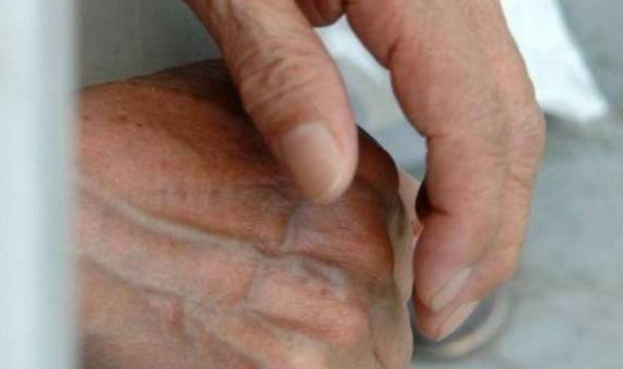 信号|肝出事手知道,手上若出现3个“信号”,或许是肝癌在敲门!