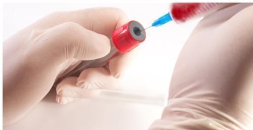 筛查|3个体检指标异常疑似胃癌,出现症状或已是晚期!胃镜该做就做