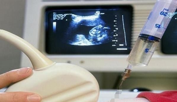 孕期|怀孕后,4个“不良习惯”可能会让羊水变浑浊,孕妈别大意