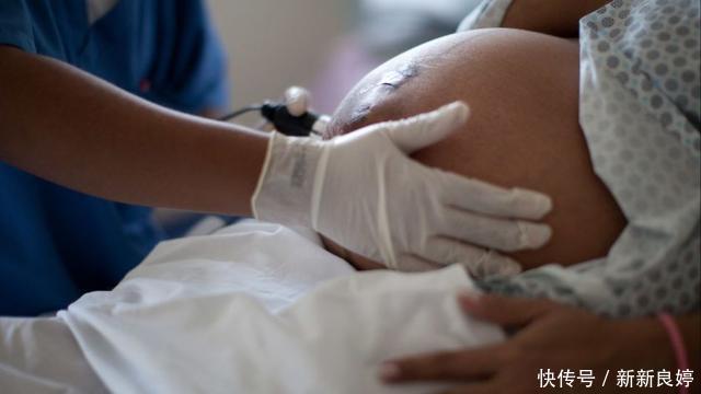 指标|孕期B超单上四个指标,暗示胎儿健康信号,达标孕妈可以放心了