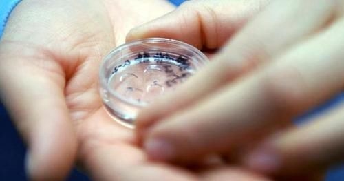 “试管婴儿”和正常孩子有什么区别不在于寿命长短，而是这一点