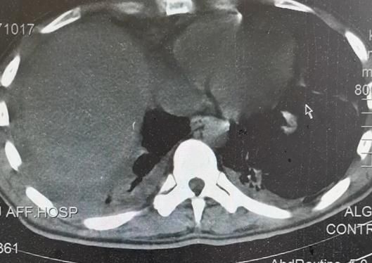 寄生虫|头皮发麻！男子吃这个东西当药引，结果身体里长满寄生虫！