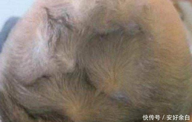毛发|孩子头顶几个“旋”有什么说法可能不少人想“错”了,不妨一看!