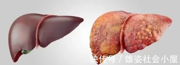 年纪|天然的养肝之王:每天必须要多吃,让你50岁的年纪拥有20岁的肝!