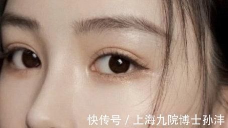 祛疤 全切双眼皮术后需要使用消除伤疤的药吗,多久可以使用?