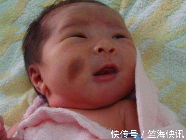 女人|女人怀孕后,尽量不要做4件事,以免宝宝脸上长胎记,别不当回事