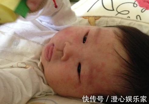 护理|宝宝出现9个特点,可能是患急疹了,教你5个方法,在家就能护理