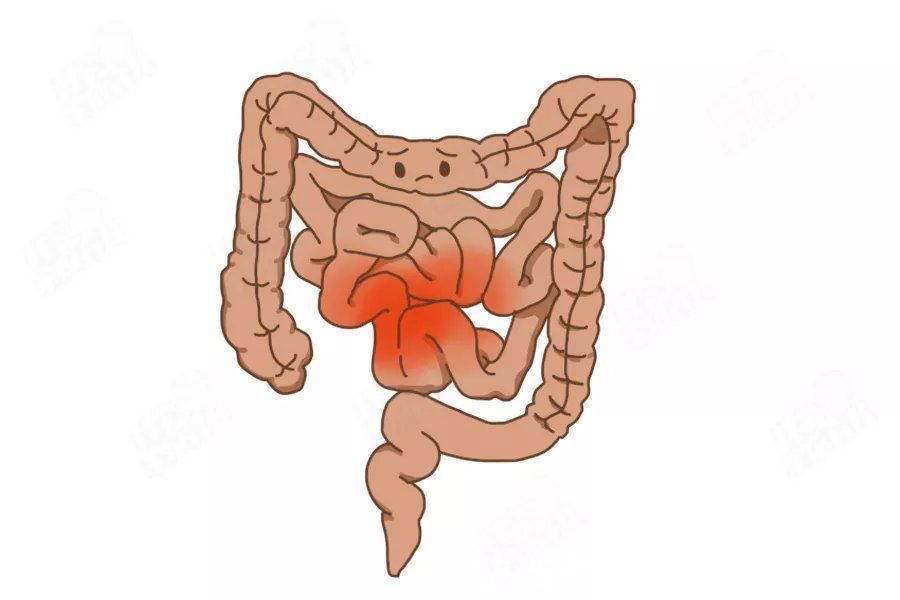 克星|吃香蕉不通便,越吃越堵!这些水果才是“便秘克星”