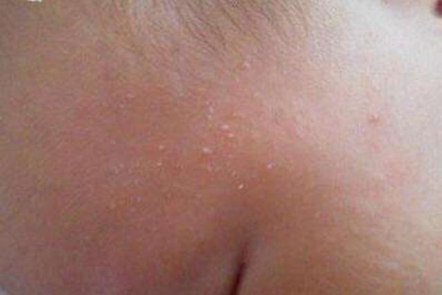 打嗝|新生儿常出现的9种问题,如何正确处理家长早知道宝宝少受罪