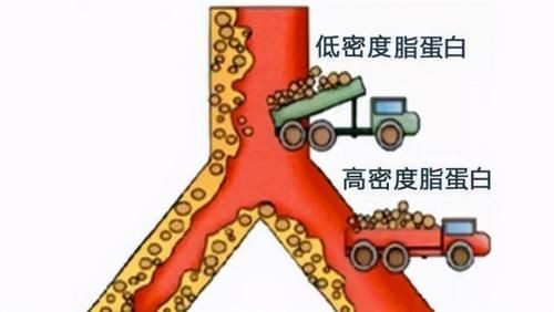 血脂升高|为什么清淡饮食血脂还高呢？医生：或是“四大原因”所致