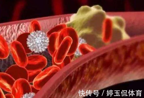 霜桑|建议中老年，若不缺钱多吃这2物，稳血脂通血管，还不贵