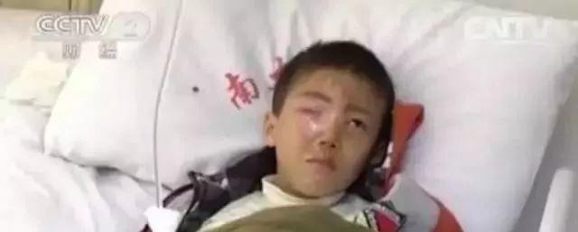 疏忽大意|20分钟孩子眼球被溶化!医生说这东西每家都有,家长要高度警惕