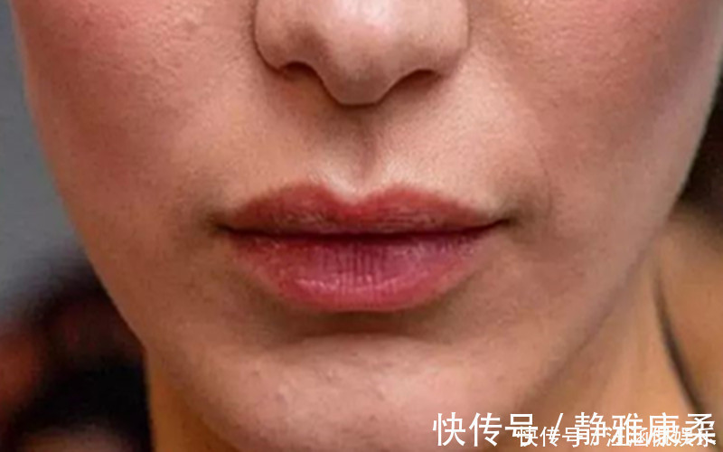 堵塞|血液粘稠的人，脸上都会有这四个表现，如果没有，你的血管不算堵