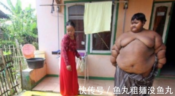 医生|男孩重达400多斤,医生检查后只能活到15岁,怒斥父母无知