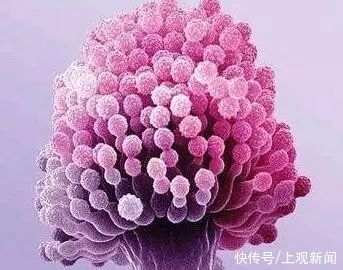 电子显微镜|比砒霜毒几十倍!这种开水都烫不死的“致癌物”,你也许每天在吃