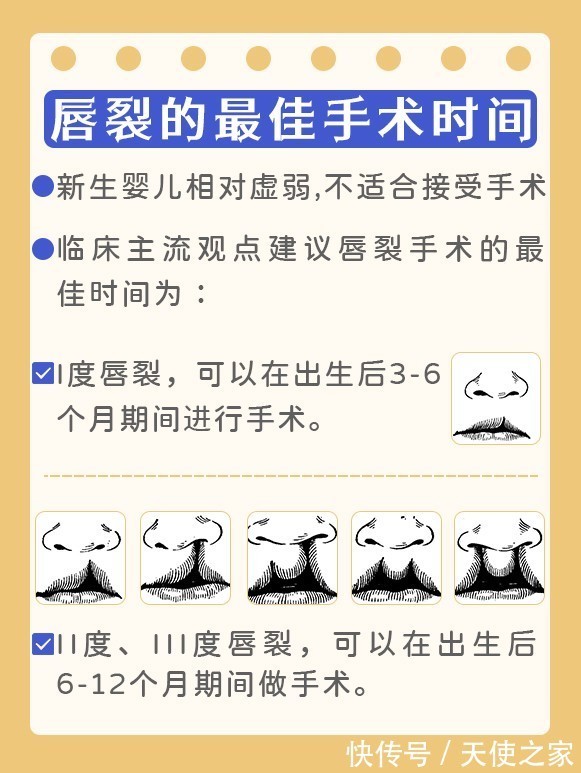 张磊涛|《天使科普》关爱兔唇宝宝 张磊涛教授带你了解唇腭裂