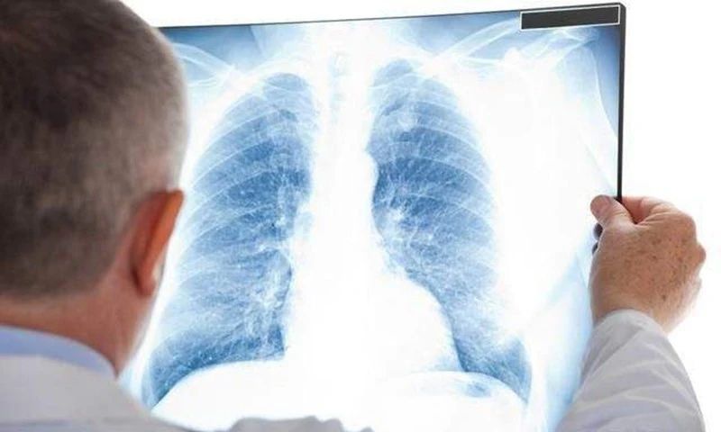 胸膜|癌症患者出现胸水,是不是病情已经进入晚期了?那可不一定