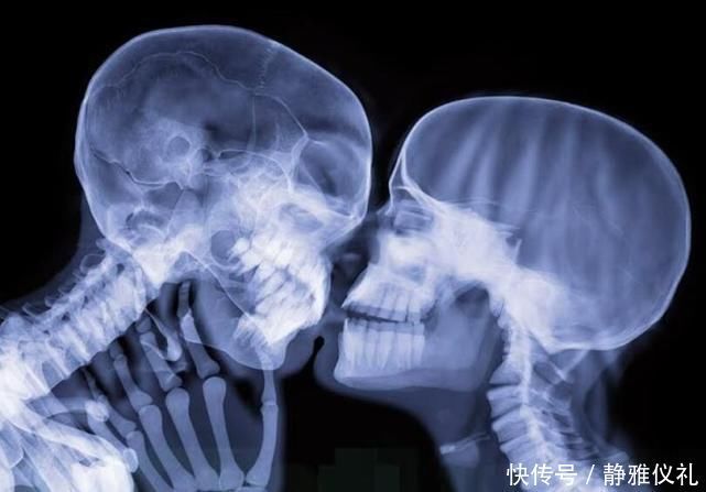 摄影 X光的世界到底长什么样杰克逊太空舞步,接吻让人哭笑不得