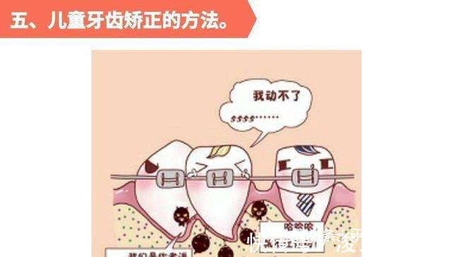 儿童|儿童牙齿矫正的黄金时期,家长们不要错过了!