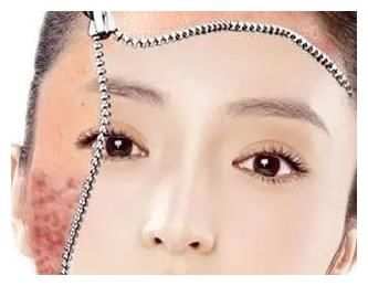 祛痘印，收缩毛孔秘诀就在这里