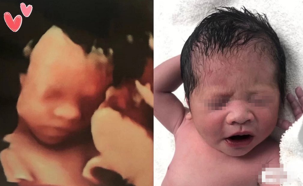 准妈妈|有种“暖心”叫胎儿心疼孕妈,用这三种方式默默保护妈妈,感动!