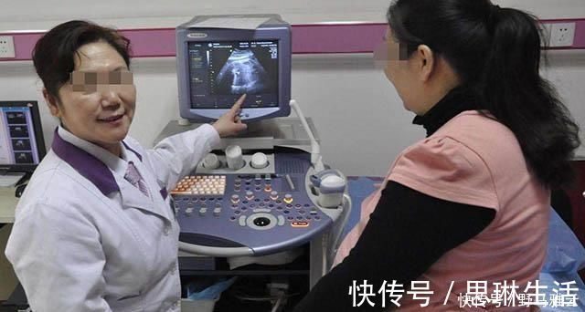 孕妇|生下双胞胎后，产妇却大喊“等一下”，医生检查后，发现意外惊喜