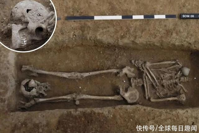 古罗马帝国|英国古代公墓出土17具无头白骨，推测为古罗马帝国时期死刑犯