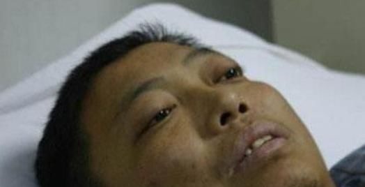 长期|肝硬化才不会“悄无声息”,早期信号一定别忽视,还好早知道