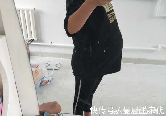 妊娠|晚孕肚子痒，可能暗示这一征兆，准妈妈别疏忽