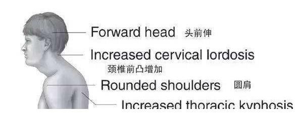 健身|健身的时候怎么避免肩关节损伤？