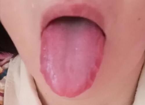 涌泉穴|肾好不好,这三种原因要知道!补肾不盲目,一定要知道3种情况