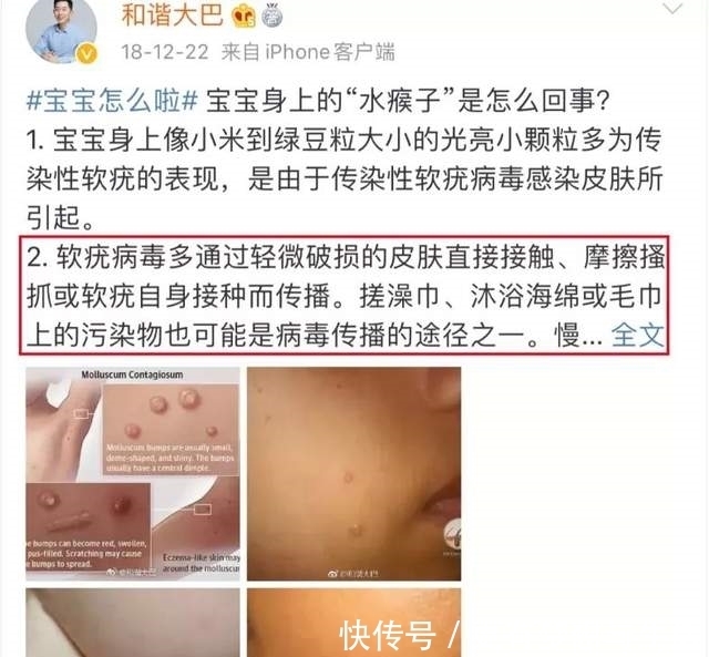 干净|冬天可以给孩子搓澡吗？用对方法很重要，既呵护皮肤又洗得干净