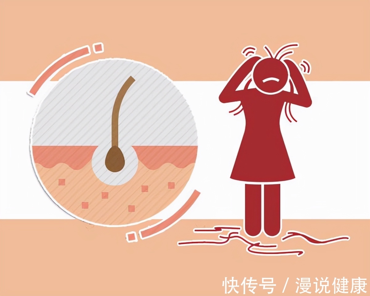 发际线|逃不过“秃顶”的宿命?一旦发现自己脱发,这份攻略请你收好