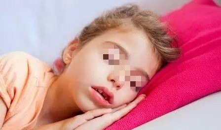 家长|睡觉用嘴呼吸和用鼻子呼吸的孩子,长大后颜值差别大,家长要重视