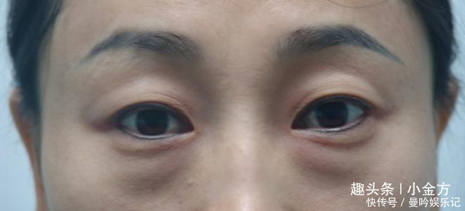 人老眼先老,2个护眼妙招,坚持一个月,好处自动找上门!