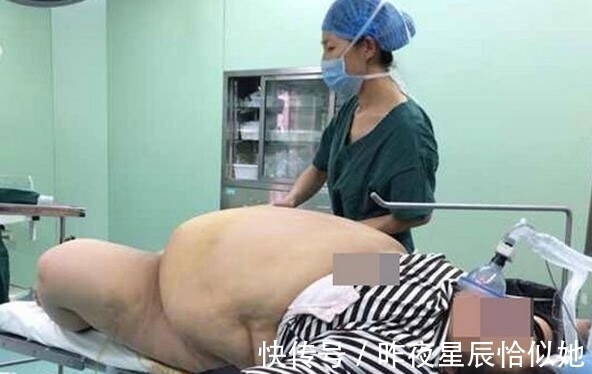 孩子|准妈妈总感觉肚里怀的不是孩子,孩子出生后,全家人都惊呆了!