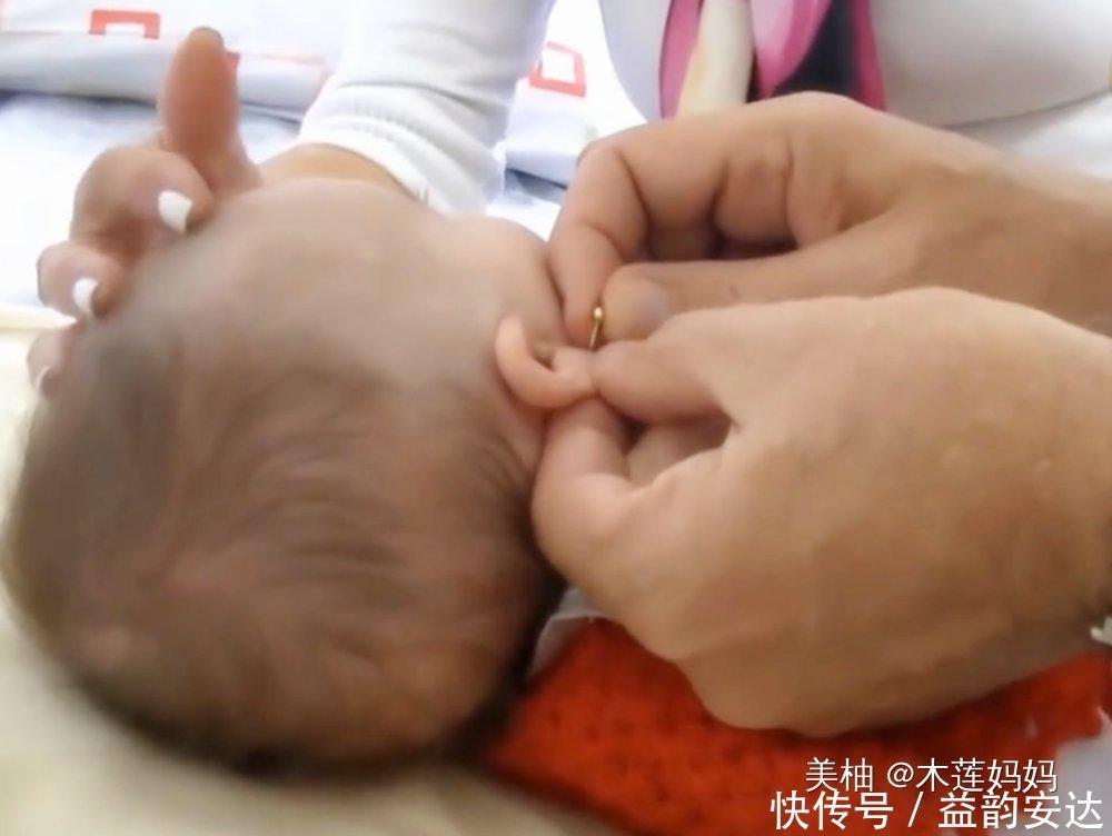 耳钉|为什么不建议家长给孩子打耳洞?专业医生表示:要去正规的医院