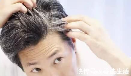 衰老|难怪你白头发越来越多,除了自然衰老外,4种食物能少碰就少碰!
